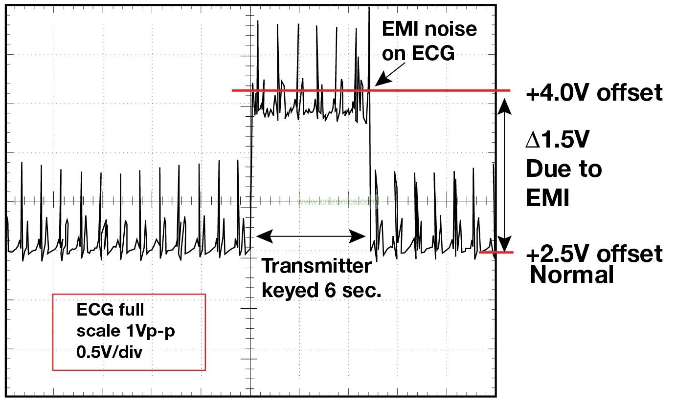 圖 1 1.5 英尺以外的發(fā)射器(f = 470 MHz, P= 0.5W)開啟和關(guān)閉時 ECG 診斷設(shè)備的心臟檢查結(jié)果