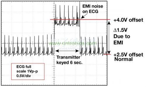 1.5 英尺以外的發(fā)射器(f = 470 MHz, P= 0.5W)開(kāi)啟和關(guān)閉時(shí)ECG 診斷設(shè)備的心臟檢查結(jié)果