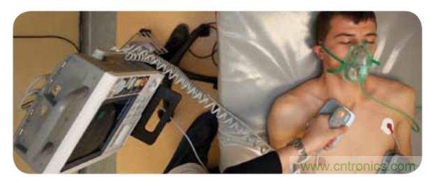 帶電極的醫(yī)院用除顫器。注意，患者身上有外部心電圖或心臟監(jiān)護(hù)儀，從胸部的白色圓片(電極)和導(dǎo)聯(lián)(線)可看出來。