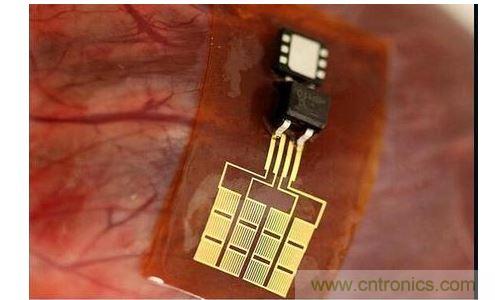 可將人體變成電腦的電子皮膚！