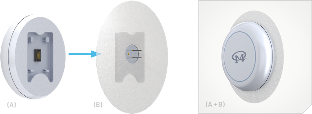 如何使用動態(tài)血糖監(jiān)測設(shè)備(CGM)管理糖尿病 如何使用動態(tài)血糖監(jiān)測設(shè)備(CGM)管理糖尿病