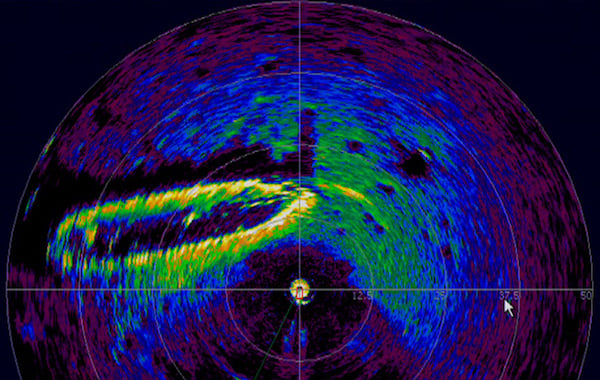 什么是激光雷達(dá)以及如何使用它？