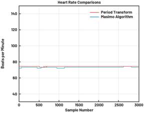 動(dòng)態(tài)離散周期變換技術(shù)突破：無ECG參考的生理信號精準(zhǔn)解析