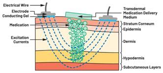  圖5.人體皮膚分層橫截面以及TMD和生物阻抗測(cè)量  考慮到生物阻抗分析的無(wú)創(chuàng)性，使用兩個(gè)金屬電極代表電氣傳感器，連接模擬前端(AFE)電路和患者皮膚。這個(gè)金屬與非金屬的接觸點(diǎn)是構(gòu)成整個(gè)電路的另一個(gè)關(guān)鍵部分，連接了AFE和人體電氣模型。電荷載體（電極中的電子和人體內(nèi)的離子）之間的相互作用可能對(duì)這些傳感器的性能產(chǎn)生重大影響，需要根據(jù)每種應(yīng)用進(jìn)行具體考慮。首先，金屬與離子溶液接觸的相互作用導(dǎo)致金屬表面附近溶液中離子濃度的局部變化。這種現(xiàn)象會(huì)改變電極下方區(qū)域的電荷中性，導(dǎo)致金屬周?chē)碾娊赓|(zhì)電位與溶液其余部分不同，從而在金屬和電解質(zhì)主體之間產(chǎn)生一個(gè)電位差，即常說(shuō)的“半電池電位”。其次，注入電流的直流分量會(huì)導(dǎo)致電極極化。  表1.各種電極類(lèi)型和相應(yīng)的半電池電位  金屬及反應(yīng)  半電池電位(V)  Al → Al3+ + 3e- Al → Al3+ + 3e-  –1.706 –1.706  Ni → Ni2+ + 2e- Ni → Ni2+ + 2e-  –0.230 -0.230  H2 → 2H+ + 2e- H2 → 2H+ + 2e-  0.000 (by definition) 0.000（根據(jù)定義）  Ag + Cl- → AgCl + e- Ag + Cl- → AgCl + e-  +0.223 +0.223  Ag → Ag+ + e- Ag → Ag+ + e-  +0.799 +0.799  Au → Au+ + e- Au → Au+ + e-  +1.680 +1.680  這是一種不良現(xiàn)象，往往導(dǎo)致電極性能下降。這些考量表明，電極也需要定義適當(dāng)?shù)碾姎饽Ｐ停▍⒁?jiàn)圖6）。我們可以將干電極表示為具有三個(gè)串聯(lián)元件的電路：一個(gè)用于模擬半電池電位(EHC)的直流電源；一個(gè)用于模擬金屬和非金屬（人體）之間接觸的RC并聯(lián)電池(Rd||Cd)；以及一個(gè)用于模擬電極金屬的電阻Rs。